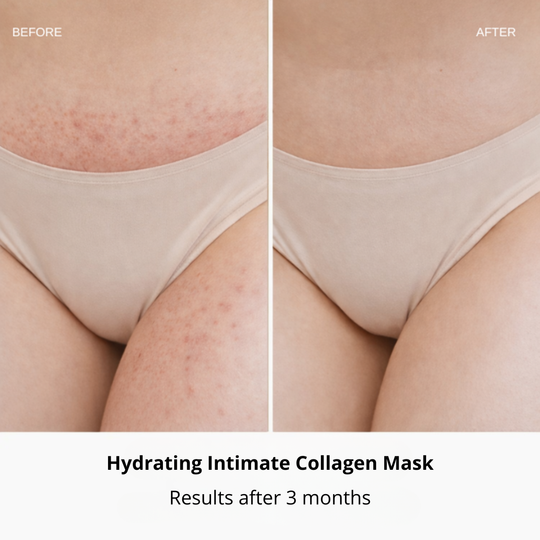 Hydrating Intimate Collagen Mask (Buy 1 Get 1 Free)